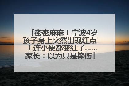 密密麻麻！宁波4岁孩子身上突然出现红点！连小便都变红了……家长：以为只是摔伤